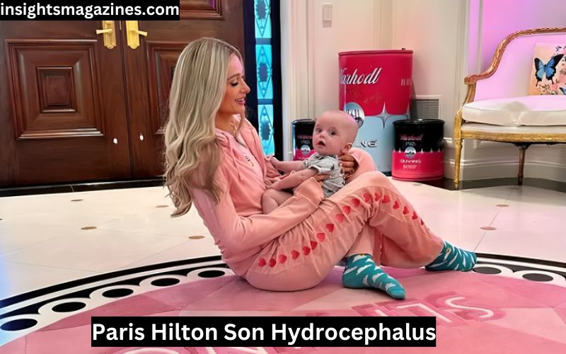 Paris Hilton Son Hydrocephalus