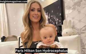 Paris Hilton Son Hydrocephalus